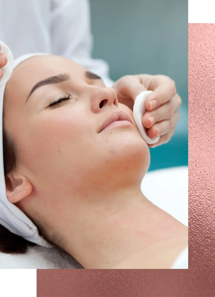 Chemical Peels - Academy Synergy Medispa