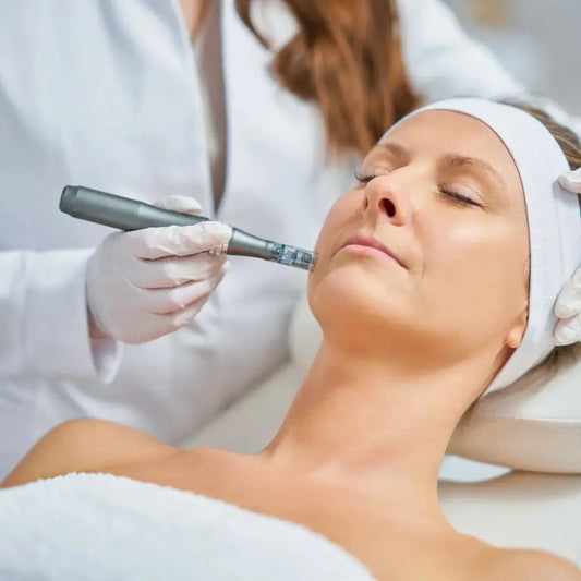 Microneedling Synergy Medispa