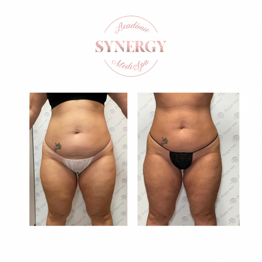 B-Shape Synergy Medi Spa