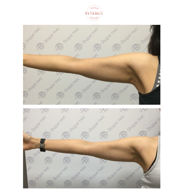 B-Shape Synergy Medi Spa