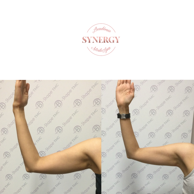 B-Shape Synergy Medi Spa